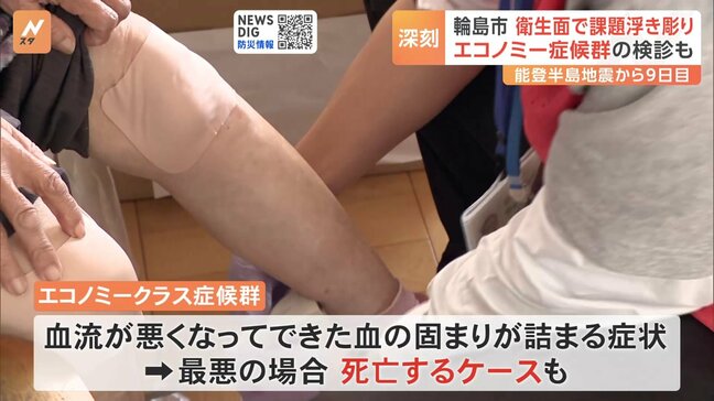 避難所でエコノミークラス症候群の検診「せっかく助かった命を避難しているだけで落とす方もいる」能登半島地震|TBS NEWS DIG