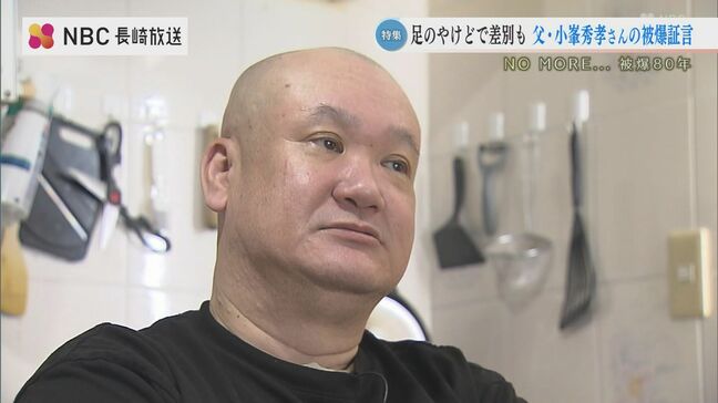 差別や離婚を乗り越え平和を訴えた小峯秀孝さん　父の遺志を継ぎ息子・英裕さんが「語り部」に|TBS NEWS DIG