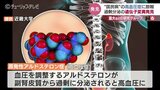日本人の3人に1人“国民病”の高血圧の一種で原因となる遺伝子変異発見　治療薬開発に期待　|　石川県のニュース｜MRO北陸放送
