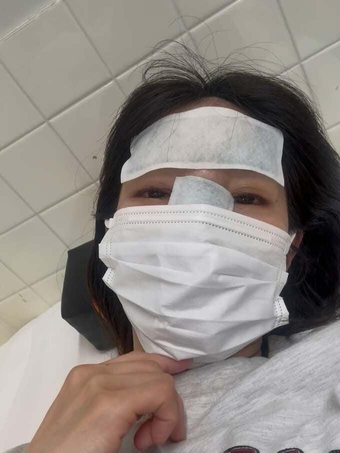 【 気象予報士・寺川奈津美 】　顔面を強打　「ダウンして点滴へ…。」「公園で滑り台を駆け上がった先の柵にゴン。見事なたんこぶ爆誕」|TBS NEWS DIG