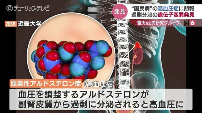 日本人の3人に1人“国民病”の高血圧の一種で原因となる遺伝子変異発見　治療薬開発に期待　|　富山のニュース｜天気・防災｜チューリップテレビ
