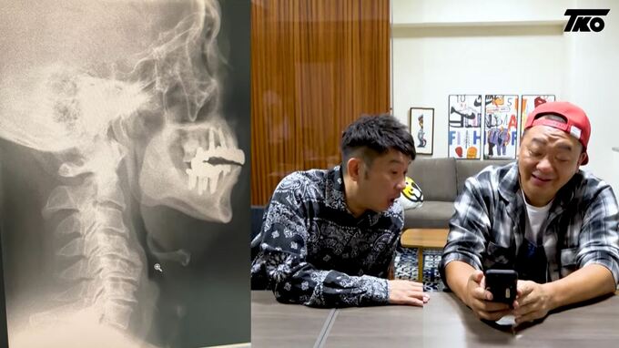 ＴＫＯ木下隆行さん　レントゲン写真に首の「ゆがみ」　「右手の不調」の原因が判明　約２年前の整体の後遺症|TBS NEWS DIG