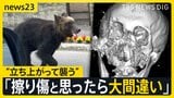 「最初の一撃で肋骨6本折れた」 クマに襲われた男性が警鐘「獣害ではなく災害」 深刻化する被害…老人ホームの裏に“3時間居座り”も【news23】|TBS NEWS DIG