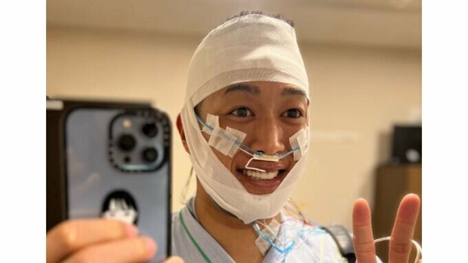 関口メンディーさん　包帯姿の写真を披露「入院しました」「自分の『睡眠』を見直したくて」|TBS NEWS DIG