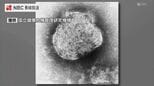 2026年2例目のはしか感染確認　発症前後の期間公共交通機関は利用せず　長崎市|TBS NEWS DIG