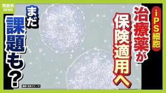 【iPS細胞】誕生から20年の時を経て実用化へ　細胞由来のパーキンソン病治療薬の保険適用了承　高まる期待も実は数々のハードルが…医療ジャーナリストが解説　|　MBSニュース | 関西の最新ニュースを分かりやすく。