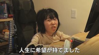 「いつか病気が治る日が来てほしい」iPS細胞・山中教授へ16歳少女の未来へ託す手紙　国内300人の難病と闘う　|　富山のニュース｜天気・防災｜チューリップテレビ