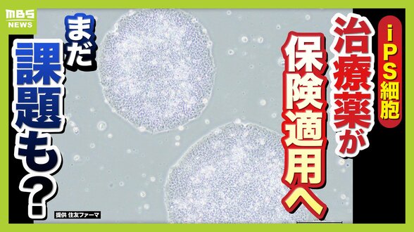 【iPS細胞】誕生から20年の時を経て実用化へ　細胞由来のパーキンソン病治療薬の保険適用了承　高まる期待も実は数々のハードルが…医療ジャーナリストが解説　|　MBSニュース | 関西の最新ニュースを分かりやすく。