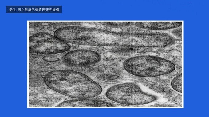 70代男性が「つつが虫病」に　感染経路は不明も5月上旬に山菜採りのために山林に→その後5月中旬に発熱や発疹など症状が…　ダニの一種「ツツガムシ」が媒介する病気　青森県|TBS NEWS DIG