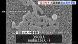 「百日せき」の患者数が5週連続で過去最多更新　全国で1週間の患者数が3908人にのぼる|TBS NEWS DIG