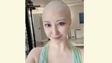 【がん闘病】西丸優子さん 2クール目の抗がん剤治療に「色々対策しながら副作用と向き合っていきたい」|TBS NEWS DIG