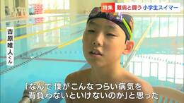 「なんで僕がこんな辛い病気を」脳動静脈奇形を克服した小学生スイマー 仲間たちと泳ぎたい その信念で【岡山】|TBS NEWS DIG