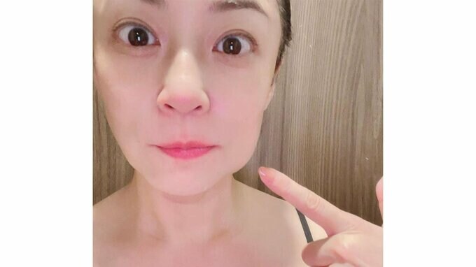 俳優・佐藤仁美さん（43）「起きたら腫れてたwwww」歯医者で受診の後に頬がパンパン|TBS NEWS DIG