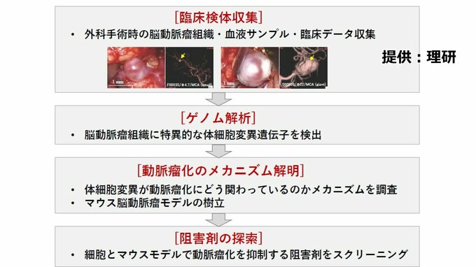 「脳動脈瘤」に薬による治療の可能性　理研など研究グループ|TBS NEWS DIG