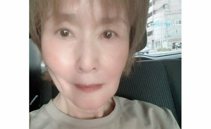 【 小柳ルミ子 】　「過去の不始末治療のせいで」「レントゲンを見ると金属片が残ってるんですよ」　歯科医院での「歯の治療の今後」明かす　先日「右の奥歯の歯茎が膿んで 腫れて」手術|TBS NEWS DIG