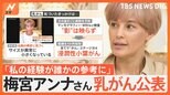 【Nスタ生出演】乳がん公表 梅宮アンナさん(51)「初めてのことなので不安と恐怖」「正しい情報の見極めが必要」|TBS NEWS DIG