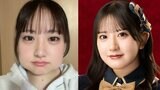 SKE48・相川暖花さん 「親知らず4本抜いた顔」 頬が腫れた写真を公開 「明後日までに腫れ引くと思いますか?」|TBS NEWS DIG