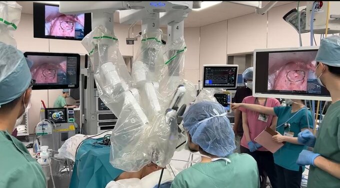 ダビンチ使った県内初の咽喉頭がんの手術　67歳男性患者の口からロボットアームなど挿入して約1時間の施術　正確性安全性の向上などに期待　保険診療の適用も　長野・信州大学医学部附属病院|TBS NEWS DIG