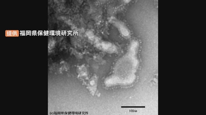 島根県で「呼吸器感染症」季節外れの流行…現場を訪ねると「コロナ」も再流行の兆し　|　BSSニュース | BSS山陰放送