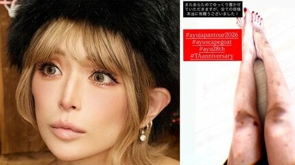 浜崎あゆみ☆取引しばらくお休みです。 浜崎あゆみ 】 「誇らしいでしかない傷だらけの脚」 ツアー開幕直後