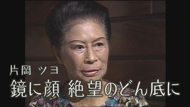 ヒバクシャの声＃8片岡ツヨ「鏡に顔　絶望のどん底に」|TBS NEWS DIG