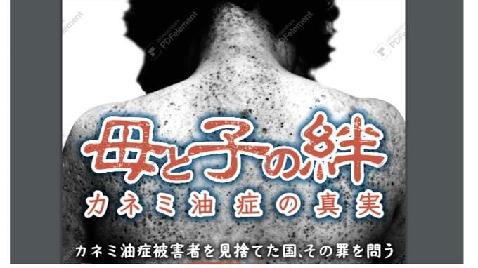 カネミ油症のドキュメンタリー映画『母と子の絆』長崎で上映　胎児に毒が移行…追い詰められる母親の心|TBS NEWS DIG
