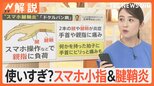 長時間スマホで…痛みや変形“スマホ小指”や腱鞘炎だけでなく、あごが前にズレる“スマホ顎関節症”にも注意【Nスタ解説】|TBS NEWS DIG