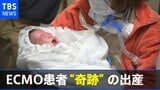 ECMO患者が“奇跡”の出産 妻と子の命どちらを優先するか 重い選択の末に・・・「産まれてきてくれて、ありがとう」|TBS NEWS DIG