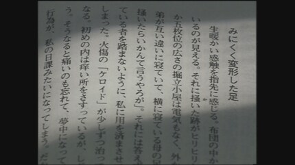 腐れ足」過酷な被爆者としての人生 長崎原爆青年乙女の会会長