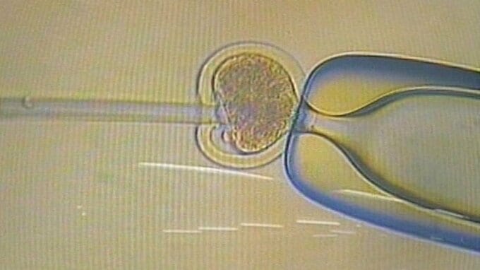ノーベル級スキャンダル、黄元教授の「ES細胞」とは？【TBSアーカイブ秘録】|TBS NEWS DIG