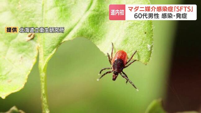 北海道でマダニ媒介「重症熱性血小板減少症候群」感染を初確認　頭痛や下痢などの症状で入院の60代男性回復へ|TBS NEWS DIG