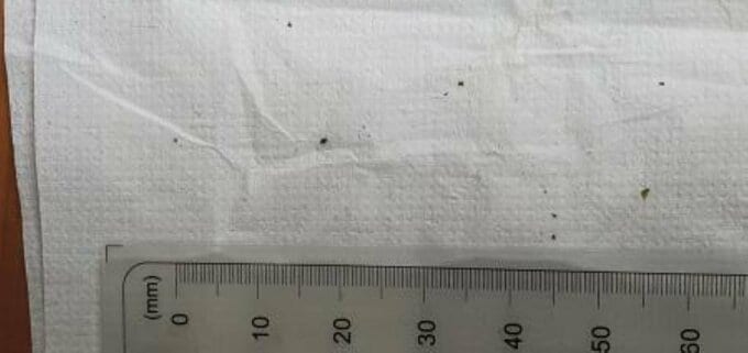 給食に虫混入 回収が間に合わず園児ら９人食べる 健康被害は確認されず【愛媛・久万高原町】|TBS NEWS DIG