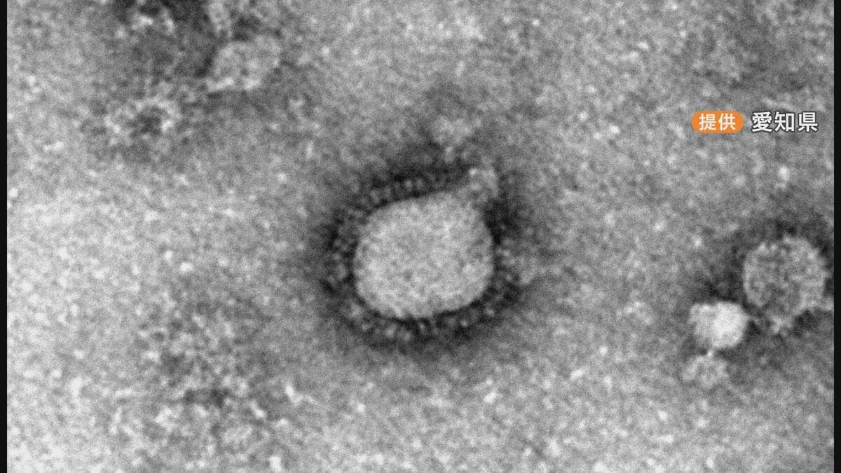 愛知に｢インフルエンザ注意報｣1医療機関あたりの患者数は11.50人に 過去10年で2番目の早さ “学級閉鎖”の数も増加