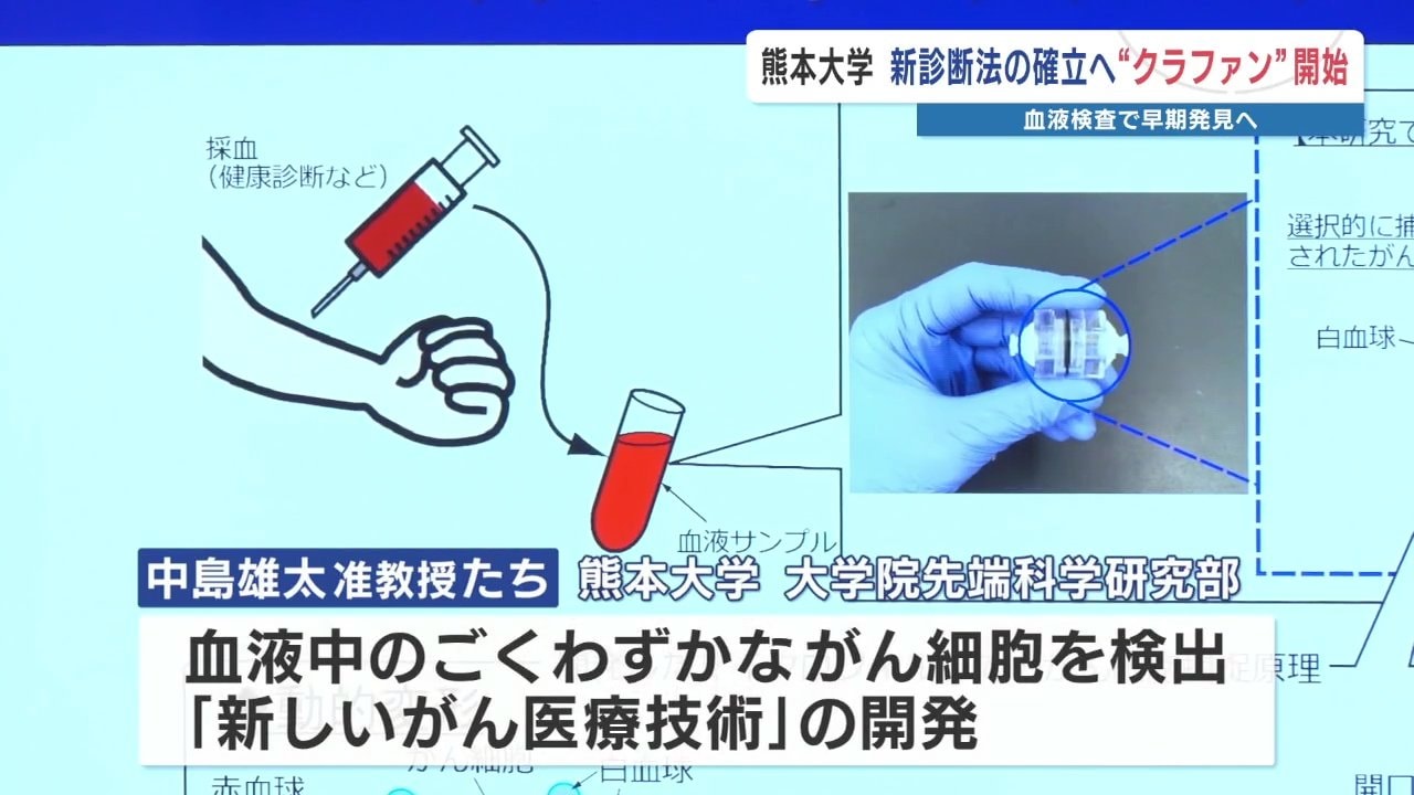 血液検査でがん早期発見へ” 熊本大学が開発費をクラファンで募集