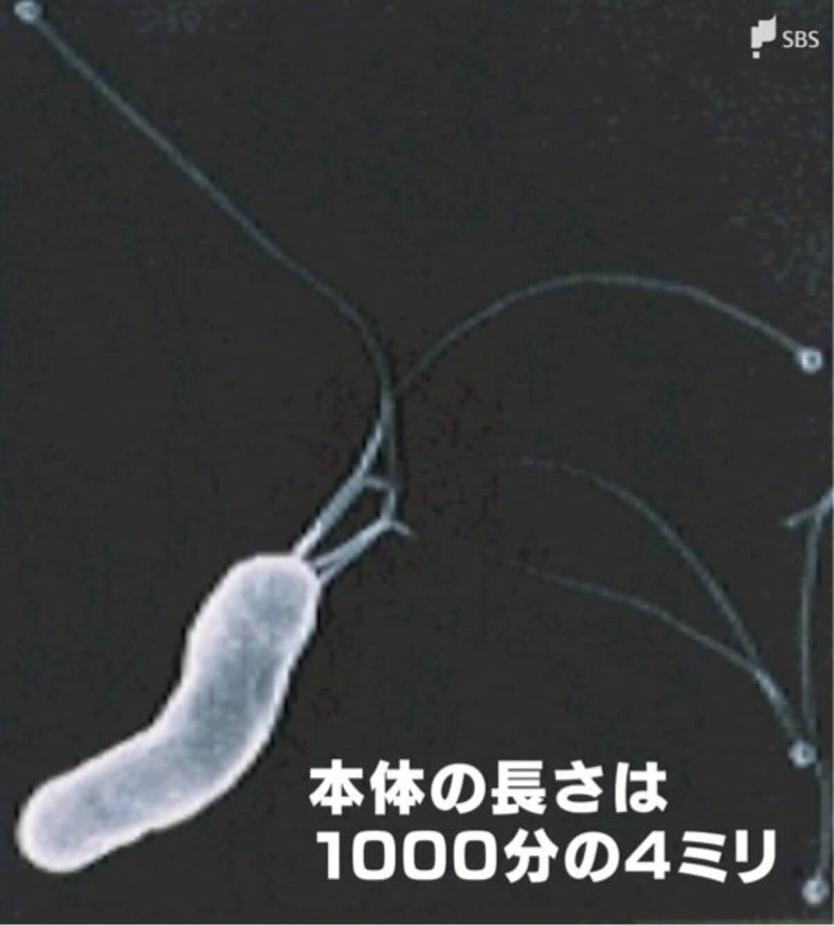 確実な発がん因子”ピロリ菌は悪玉菌か それとも善玉菌か 50代以上の