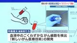 “血液検査でがん早期発見へ” 熊本大学が開発費をクラファンで募集「胃がん食道がん以外にも可能性広がる」 | 熊本のニュース|RKK NEWS|RKK熊本放送