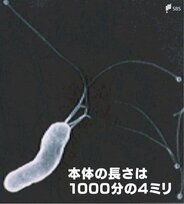 “確実な発がん因子”ピロリ菌は悪玉菌か それとも善玉菌か 50代以上の感染者は「毎年の胃カメラが有効」 | 静岡のニュース | SBSNEWS | 静岡放送