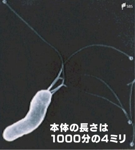 ヒロリ菌です。① ピロリ菌｜岩出市の豊田内科