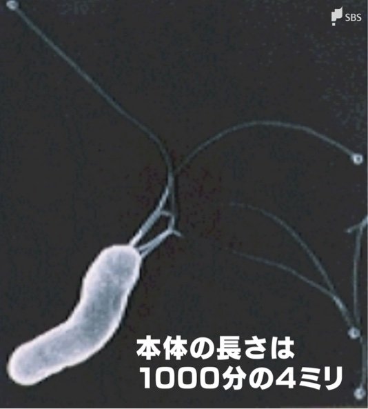 “確実な発がん因子”ピロリ菌は悪玉菌か それとも善玉菌か 50代以上の感染者は「毎年の胃カメラが有効」|TBS NEWS DIG