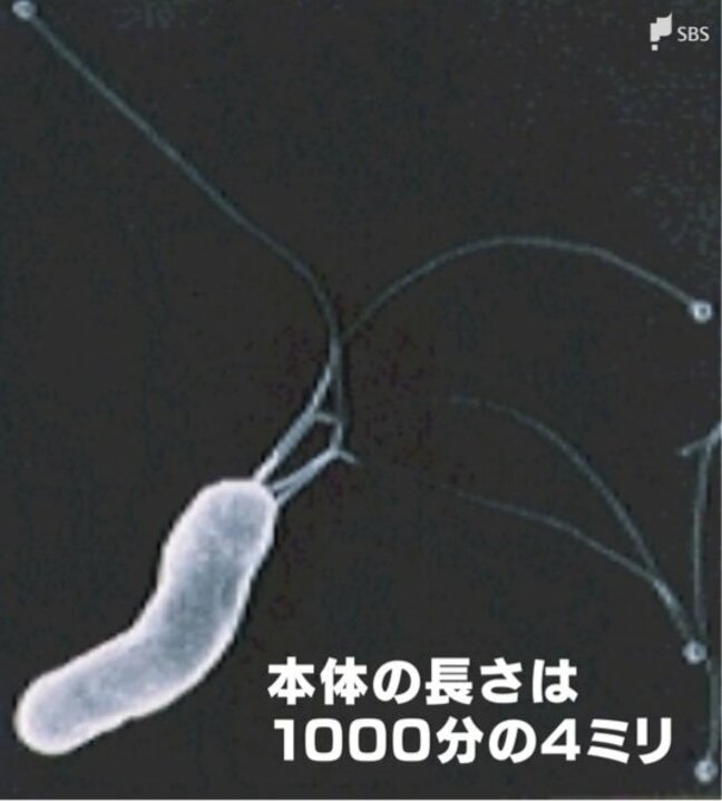 “確実な発がん因子”ピロリ菌は悪玉菌か それとも善玉菌か 50代以上の感染者は「毎年の胃カメラが有効」|TBS NEWS DIG