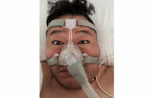 【 元大相撲力士・豊ノ島 】　睡眠時無呼吸症候群を公表　「CPAPのおかげで上質な睡眠」　海外遠征にも必携の装置|TBS NEWS DIG