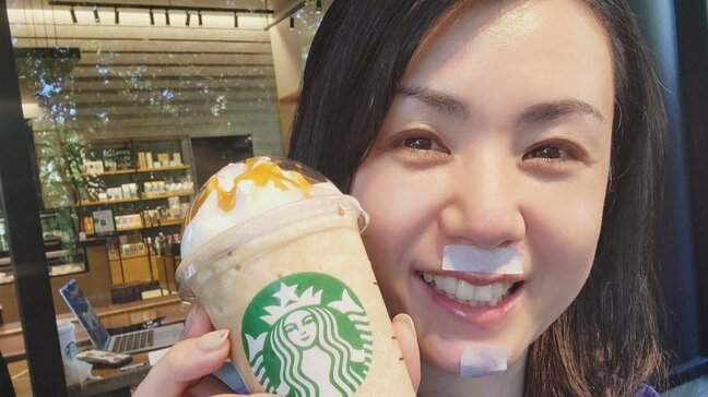 【 小島可奈子 】顔の怪我「経過のご報告」　 “9月の写真展までには目立たなく” 　保険外診療も模索へ「出来うる限り」|TBS NEWS DIG