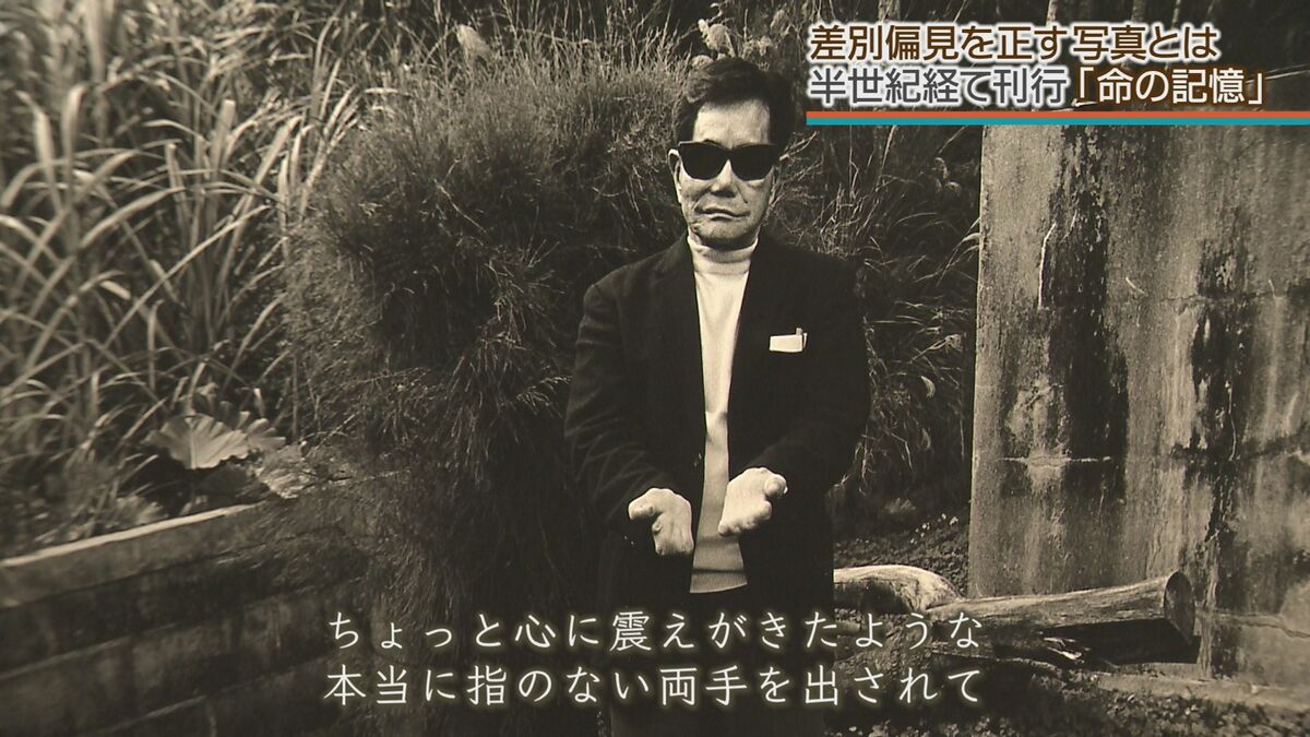「撮りなさい」そう言って男性は指が1本もない両手を差し出した…誤ったハンセン病隔離政策の犠牲者たち　50年前の『命の記憶』伝える写真集