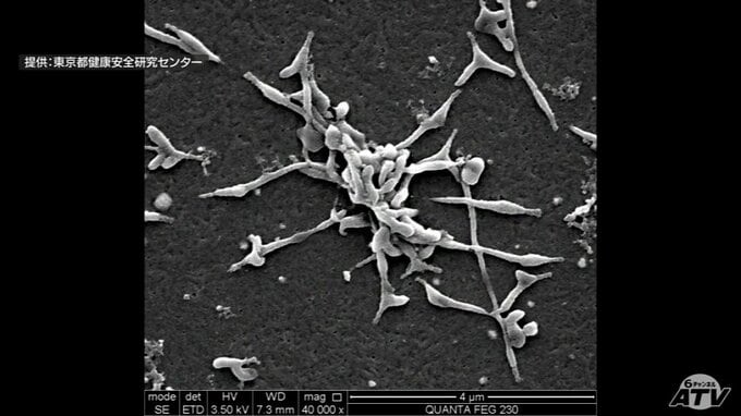 「マイコプラズマ肺炎」1医療機関あたりの患者数が青森県は8週連続で4人超え　全国2番目の多さに　|　青森のニュース│ATV NEWS│青森テレビ