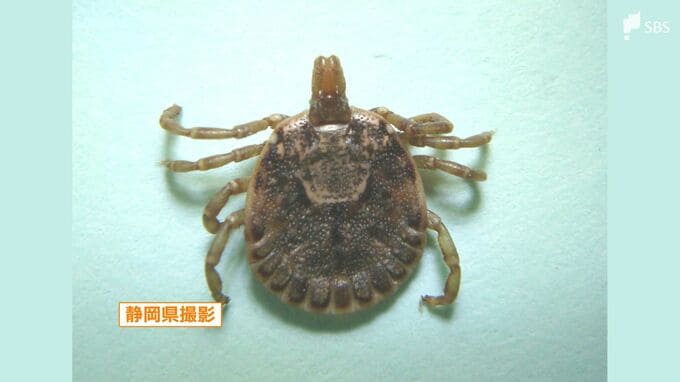 マダニに刺されると肉が食べられなくなる?! 原因は人間にない「アルファギャル」　|　静岡のニュース | SBSNEWS | 静岡放送