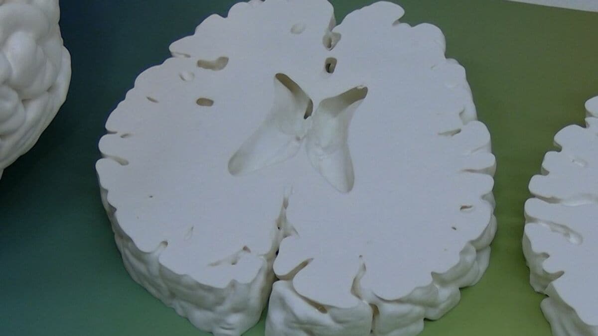 「薬物依存で変化した脳の模型」など175点　川崎医療福祉大学の卒業制作展「医療に関する問題や不安をわかりやすく表現　解決への理解を深めて」