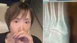 【 奈美悦子(75) 】絨毯に引っかかりテレビに激突　「右足にヒビが　情けない話です」「しばらく大人しくしています」|TBS NEWS DIG