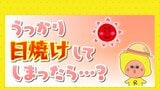 この時期でもあなどれない紫外線　もしうっかり日焼けしてしまったら、、、？|TBS NEWS DIG