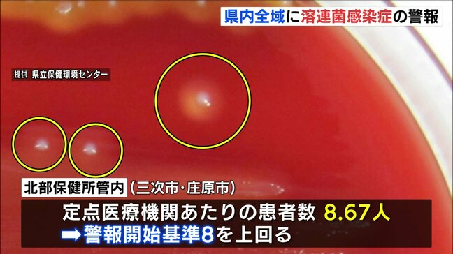 学童期の子どもは特に注意　広島県全域に「溶連菌咽頭炎警報」　「うがい」「手洗い」の徹底を|TBS NEWS DIG