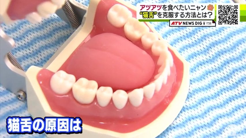「猫舌」は克服できる!?歯科医が教えるその方法は“舌”の使い方 熱い牛丼もこれで安心 | TBS NEWS DIG